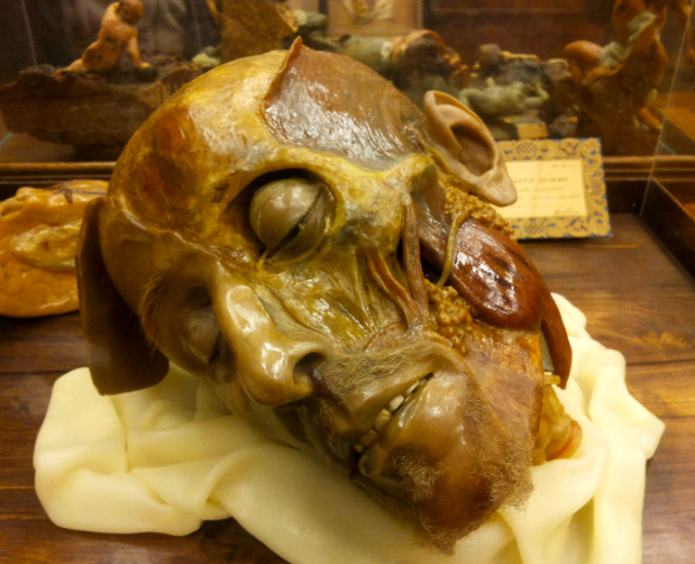 Anatomisko vaska figūru muzejs - Cagliari | Secret World Trip Planner